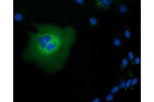 Anti-TCP11L2 mouse monoclonal antibody (ABIN2453717) immunofluorescent staining of COS7 cells transiently transfected by pCMV6-ENTRY TCP11L2 (RC207129). (TCP11L2 antibody)