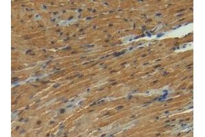 Detection of S100 in Mouse Heart Tissue using Polyclonal Antibody to S100 Calcium Binding Protein (S100) (S100 Protein (S100) (AA 2-94) antibody)