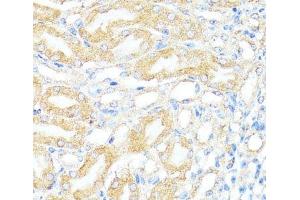 Immunohistochemistry of paraffin-embedded Mouse kidney using BAX Polyclonal Antibody at dilution of 1:100 (40x lens).