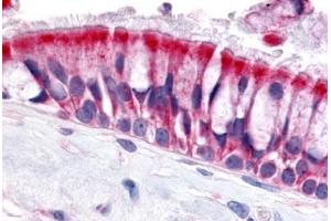 Anti-OR6N1 antibody  ABIN1049187 IHC staining of human nasal mucosa, respiratory epithelium. (OR6N1 antibody  (Extracellular Domain))