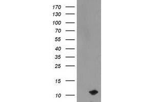 HEK293T cells were transfected with the pCMV6-ENTRY control (Left lane) or pCMV6-ENTRY PDE6G (Right lane) cDNA for 48 hrs and lysed. (PDE6G antibody)