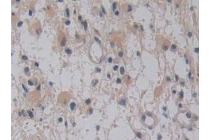 Immunohistochemistry (IHC) image for anti-Transmembrane Protease, serine 4 (TMPRSS4) (AA 54-437) antibody (ABIN7436138)