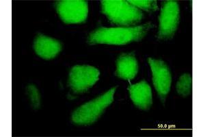 Immunofluorescence of monoclonal antibody to MAP2K5 on HeLa cell. (MAP2K5 antibody  (AA 1-120))