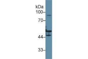Mouse Capture antibody from the kit in WB with Positive Control: Human hela cell lysate.