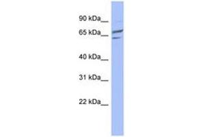 Image no. 1 for anti-Phosphoglucomutase 1 (PGM1) (C-Term) antibody (ABIN6744067)