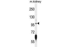 ATPGD1 Antibody (N-term) western blot analysis in mouse kidney tissue lysates (35µg/lane). (CARNS1 antibody  (N-Term))