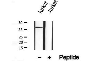 Western blot analysis of extracts from Jurkat, using Syntaxin 16 antibody.