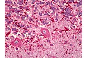 Anti-KDEL Receptor antibody IHC of human brain, cerebellum. (KDELR antibody)