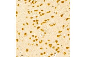 Immunohistochemistry of paraffin embedded mouse brain using BPTF (ABIN7073234) at dilution of 1:500 (400x lens) (BPTF antibody)