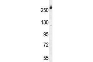 Western Blotting (WB) image for anti-Carbamoyl-Phosphate Synthetase 2, Aspartate Transcarbamylase, and Dihydroorotase (CAD) (AA 780-809) antibody (ABIN3030276)