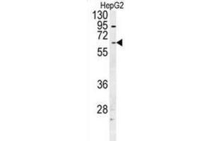 Western Blotting (WB) image for anti-UDP Glucuronosyltransferase 1 Family, Polypeptide A1 (UGT1A1) antibody (ABIN2997636) (UGT1A1 antibody)