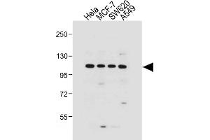 All lanes : Anti-G Antibody (N-term) at 1:1000 dilution Lane 1: Hela whole cell lysate Lane 2: MCF-7 whole cell lysate Lane 3: S whole cell lysate Lane 4: A549 whole cell lysate Lysates/proteins at 20 μg per lane. (GAA antibody  (N-Term))