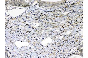 IHC analysis of VEGF Receptor 2  using anti-VEGF Receptor 2  antibody . (VEGFR2/CD309 antibody  (AA 20-242))