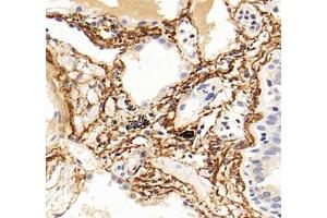Immunohistochemistry analysis of paraffin-embedded human lung using,MFAP4 (ABIN7074614) at dilution of 1: 2000 (MFAP4 antibody)