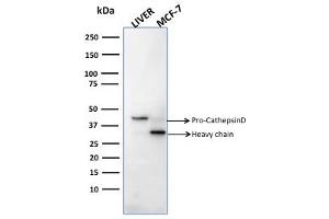 Western Blot Analysis of human liver tissue and MCF-7 cell lysates usingCathepsin D Mouse Monoclonal Antibody (CTSD/2781). (Cathepsin D antibody  (AA 104-250))