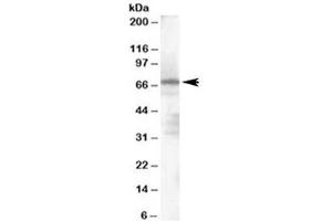Western blot testing of human spleen lysate with PARP2 antibody at 1ug/ml. (PARP2 antibody)