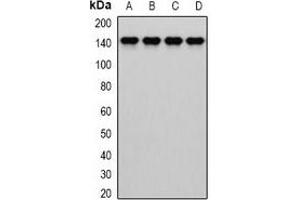Western blot analysis of Dia 1 expression in MCF7 (A), HepG2 (B), mouse liver (C), mouse lung (D) whole cell lysates. (CYB5R3 antibody)