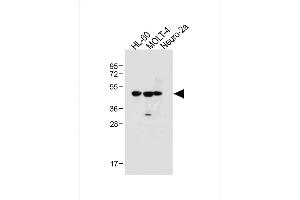 All lanes : Anti-BLMH Antibody (Center) at 1:1000 dilution Lane 1: HL-60 whole cell lysate Lane 2: MOLT-4 whole cell lysate Lane 3: Neuro-2a whole cell lysate Lysates/proteins at 20 μg per lane. (BLMH antibody  (AA 212-242))