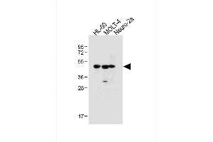 All lanes : Anti-BLMH Antibody (Center) at 1:1000 dilution Lane 1: HL-60 whole cell lysate Lane 2: MOLT-4 whole cell lysate Lane 3: Neuro-2a whole cell lysate Lysates/proteins at 20 μg per lane. (BLMH antibody  (AA 212-242))