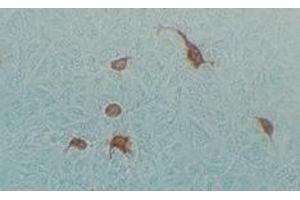 Immunohistochemical staining using MAb-Ad-H-2 antibody on Adenovirus AV2 infected Hela cells (Human Adenovirus Hexon (HAdV Hexon) antibody)