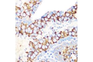 Immunohistochemistry of paraffin-embedded mouse testis using RUVBL1/TIP49A/PONTIN Rabbit mAb (ABIN7270118) at dilution of 1:100 (40x lens). (RUVBL1 antibody)