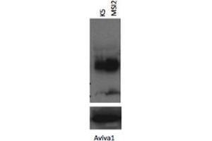 MSI2 antibody - N-terminal region  validated by WB using K562 cells lysate at 1:1000. (MSI2 antibody  (N-Term))