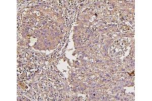 IHC analysis of IRS1 using anti-IRS1 antibody (ABIN7599659). (IRS1 antibody  (AA 1041-1242))
