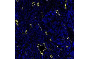 Immunofluorescence (IF) image for anti-Cadherin 5 (CDH5) (AA 48-599) antibody (ABIN7455190) (Recombinant Cadherin 5 antibody  (AA 48-599))