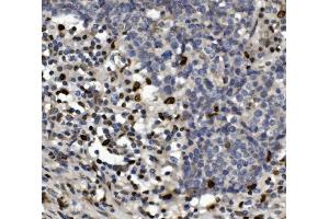 IHC analysis of SAMHD1 using anti-SAMHD1 antibody (ABIN7601516). (SAMHD1 antibody  (AA 37-626))