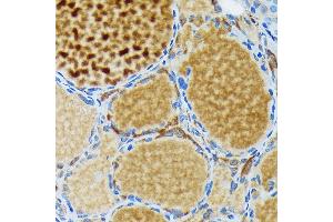 Immunohistochemistry of paraffin-embedded rat thyroid using Thyroid Peroxidase Rabbit mAb (ABIN7270865) at dilution of 1:100 (40x lens). (TPO antibody)
