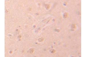 Used in DAB staining on fromalin fixed paraffin-embedded Heart tissue (PHPT1 antibody  (AA 1-125))