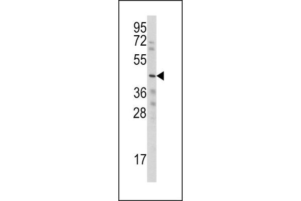 WISP3 antibody  (AA 305-335)