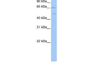 WB Suggested Anti-WASF3 Antibody Titration: 0. (WASF3 antibody  (N-Term))