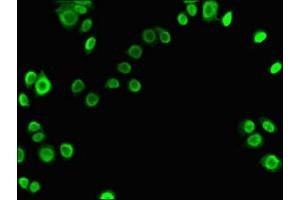 Immunofluorescent analysis of PC-3 cells using ABIN7175905 at dilution of 1:100 and Alexa Fluor 488-congugated AffiniPure Goat Anti-Rabbit IgG(H+L) (XRCC6 antibody  (AA 2-609))