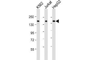 All lanes : Anti-IQSEC2 Antibody (Center) at 1:2000 dilution Lane 1: K562 whole cell lysates Lane 2: Jurkat whole cell lysates Lane 3: HepG2 whole cell lysates Lysates/proteins at 20 μg per lane. (IQSEC2 antibody  (AA 451-484))