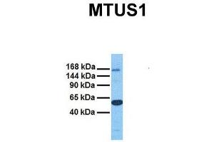 Host:  Rabbit  Target Name:  MTUS1  Sample Tissue:  Human Ovary Tumor  Antibody Dilution:  1. (MTUS1 antibody  (Middle Region))