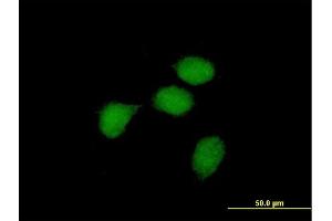 Immunofluorescence of purified MaxPab antibody to BCL3 on HeLa cell. (BCL3 antibody  (AA 1-446))