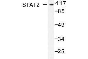 Image no. 1 for anti-Signal Transducer and Activator of Transcription 2, 113kDa (STAT2) antibody (ABIN271825) (STAT2 antibody)
