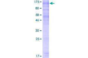 RNF139 Protein (AA 1-664) (GST tag)