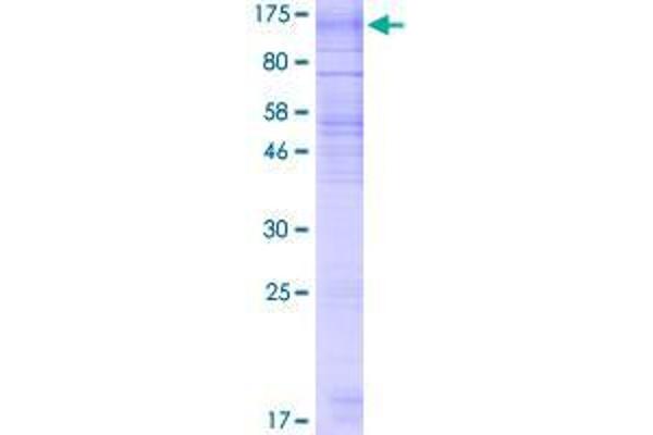 RNF139 Protein (AA 1-664) (GST tag)