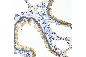 Immunohistochemistry of paraffin-embedded rat lung using ANGPT1 antibody (ABIN5974767) at dilution of 1/100 (40x lens). (Angiopoietin 1 antibody)