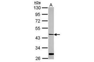 Image no. 1 for anti-Hepsin (HPN) (AA 202-400) antibody (ABIN1498709) (Hepsin antibody  (AA 202-400))