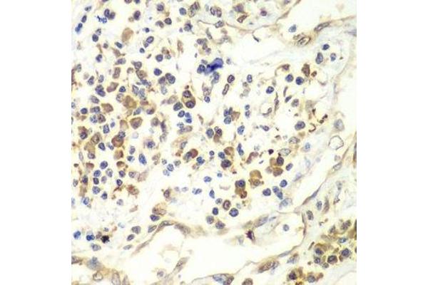 RENT1/UPF1 antibody  (AA 270-370)