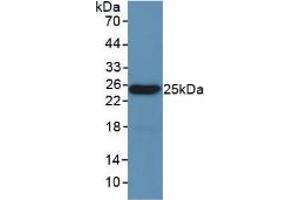 Western blot analysis of recombinant Mouse LEP.