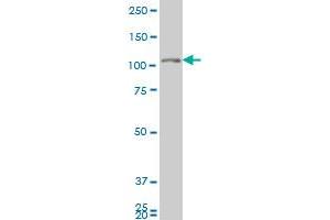 GUCY2C monoclonal antibody (M04A), clone 2H8 Western Blot analysis of GUCY2C expression in U-2 OS . (GUCY2C antibody  (AA 24-133))