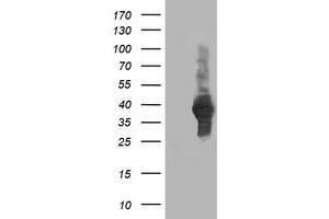 HEK293T cells were transfected with the pCMV6-ENTRY control (Left lane) or pCMV6-ENTRY ATG3 (Right lane) cDNA for 48 hrs and lysed. (ATG3 antibody)