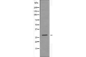 Western blot analysis of extracts from rat brain cells, using ANP32B antibody. (ANP32B antibody)