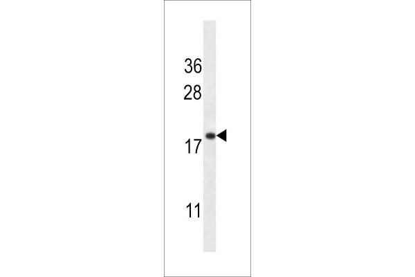 Transmembrane Protein 70 (TMM70) (AA 231-260), (C-Term) 抗体