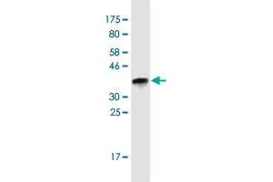 Western Blot detection against Immunogen (36. (SAGE1 antibody  (AA 357-455))