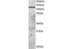 ABIN184814 staining (2µg/ml) of HepG2 lysate (RIPA buffer, 30µg total protein per lane). (RNF31 antibody  (C-Term))